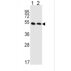 Solute Carrier Family 47 Member 1 (SLC47A1) Antibody