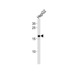 High Mobility Group Protein HMGI-C (HMGA2) Antibody