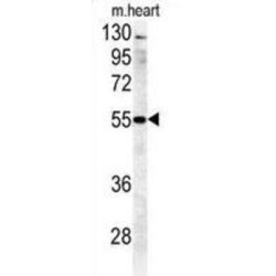 Beta-1,4-Galactosyltransferase 5 (B4GALT5) Antibody