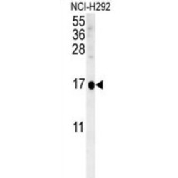 Suppressor Of IKBKE 1 (SIKE1) Antibody