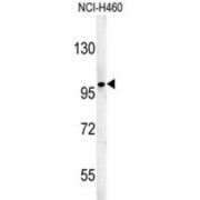 ST18, C2H2C-Type Zinc Finger (ST18) Antibody