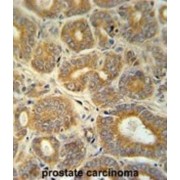 Cellular Retinoic Acid-Binding Protein 1 (CRABP1) Antibody