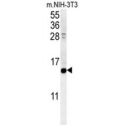 Cellular Retinoic Acid-Binding Protein 1 (CRABP1) Antibody