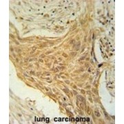 Chondrosarcoma-Associated Gene 2/3 Protein (CSAG2) Antibody