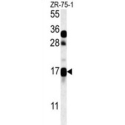 Chondrosarcoma-Associated Gene 2/3 Protein (CSAG2) Antibody