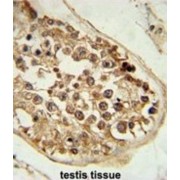 DEP Domain Containing 1 (DEPDC1) Antibody