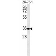 Zinc Finger Protein DPF3 (DPF3) Antibody