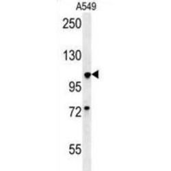 Mitotic Checkpoint Serine/Threonine-Protein Kinase BUB1 (BUB1) Antibody