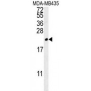 Triggering Receptor Expressed On Myeloid Cells 2 (TREM2) Antibody
