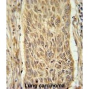 Indolethylamine N-Methyltransferase (INMT) Antibody