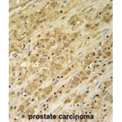 H/ACA Ribonucleoprotein Complex Subunit DKC1 (DKC1) Antibody