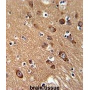 Synaptotagmin 13 (SYT13) Antibody