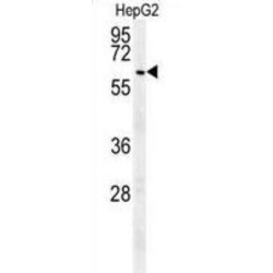 Ubiquitin-Specific-Processing Protease 17 (UBP17) Antibody