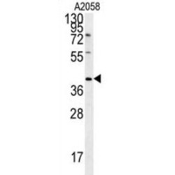 CD99 Molecule Like 2 (CD99L2) Antibody