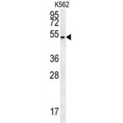 Hedgehog Acyltransferase (HHAT) Antibody