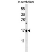 CA095 Antibody