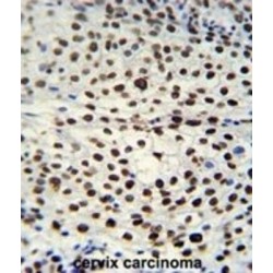 HNRPAB Antibody