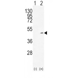 Alcohol Dehydrogenase 1C (Class I), Gamma Polypeptide (ADH1C) Antibody
