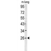 DnaJ Homolog Subfamily C Member 8 (DNJC8) Antibody