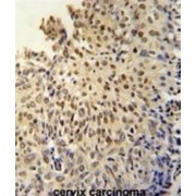 DIS3-Like Exonuclease 1 (DI3L1) Antibody