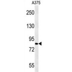 Cytoplasmic Polyadenylation Element Binding Protein 4 (CPEB4) Antibody