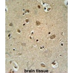 Tripartite Motif-Containing Protein 50 (TRIM50) Antibody