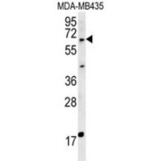 Makorin Ring Finger Protein 3 (MKRN3) Antibody