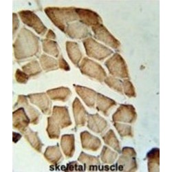 Lactate Dehydrogenase D (LDHD) Antibody