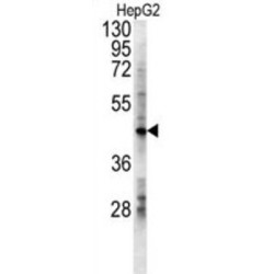 Lactate Dehydrogenase D (LDHD) Antibody