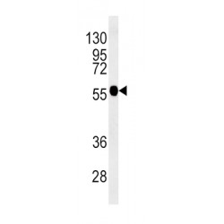 Tubulin Beta 3 (TUBB3) Antibody