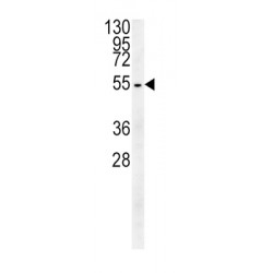 Tubulin Beta 3 (TUBB3) Antibody