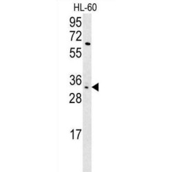 Killer Cell Immunoglobulin-Like Receptor 2DS3 (KIR2DS3) Antibody