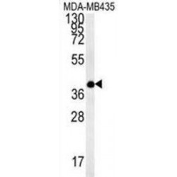 Transmembrane Protein 111 (TM111) Antibody