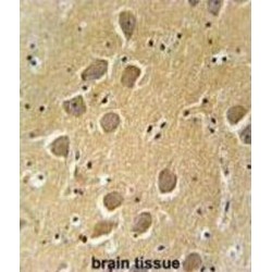 Aquaporin-11 (AQP11) Antibody