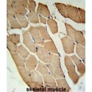 Olfactomedin Like 2A (OLFML2A) Antibody