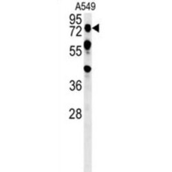 Olfactomedin Like 2A (OLFML2A) Antibody