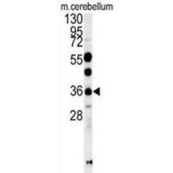 OTU Domain Containing 6B (OTUD6B) Antibody