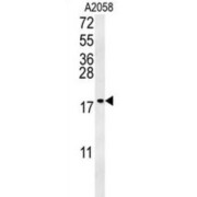 Ganglioside GM2 Activator (GM2A) Antibody