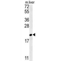 Ganglioside GM2 Activator (GM2A) Antibody