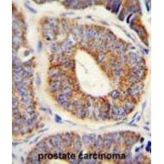 DnaJ (Hsp40) Homolog, Subfamily A, Member 1 (DNAJA1) Antibody