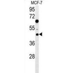 DnaJ (Hsp40) Homolog, Subfamily A, Member 1 (DNAJA1) Antibody