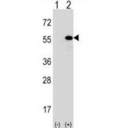 DnaJ (Hsp40) Homolog, Subfamily A, Member 1 (DNAJA1) Antibody