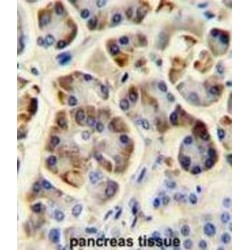 Potassium Voltage-Gated Channel Subfamily J Member 6 (KCNJ6) Antibody