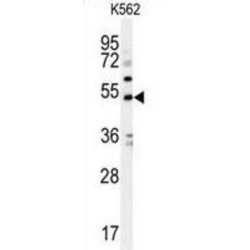 Potassium Voltage-Gated Channel Subfamily J Member 6 (KCNJ6) Antibody