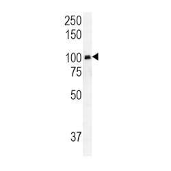 RAS Guanyl-Releasing Protein 1 (RASGRP1) Antibody