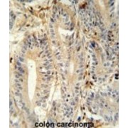 Meprin A Subunit Alpha (MEP1A) Antibody