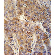 Vesicle-Associated Membrane Protein 4 (VAMP4) Antibody