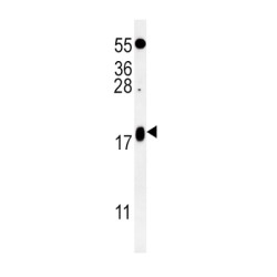 Vesicle-Associated Membrane Protein 4 (VAMP4) Antibody