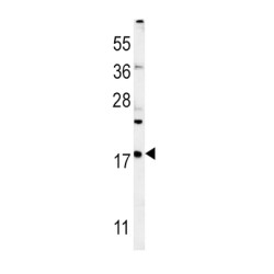 Vesicle-Associated Membrane Protein 4 (VAMP4) Antibody