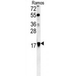 ADP-Ribosylation Factor 1 (ARF1) Antibody